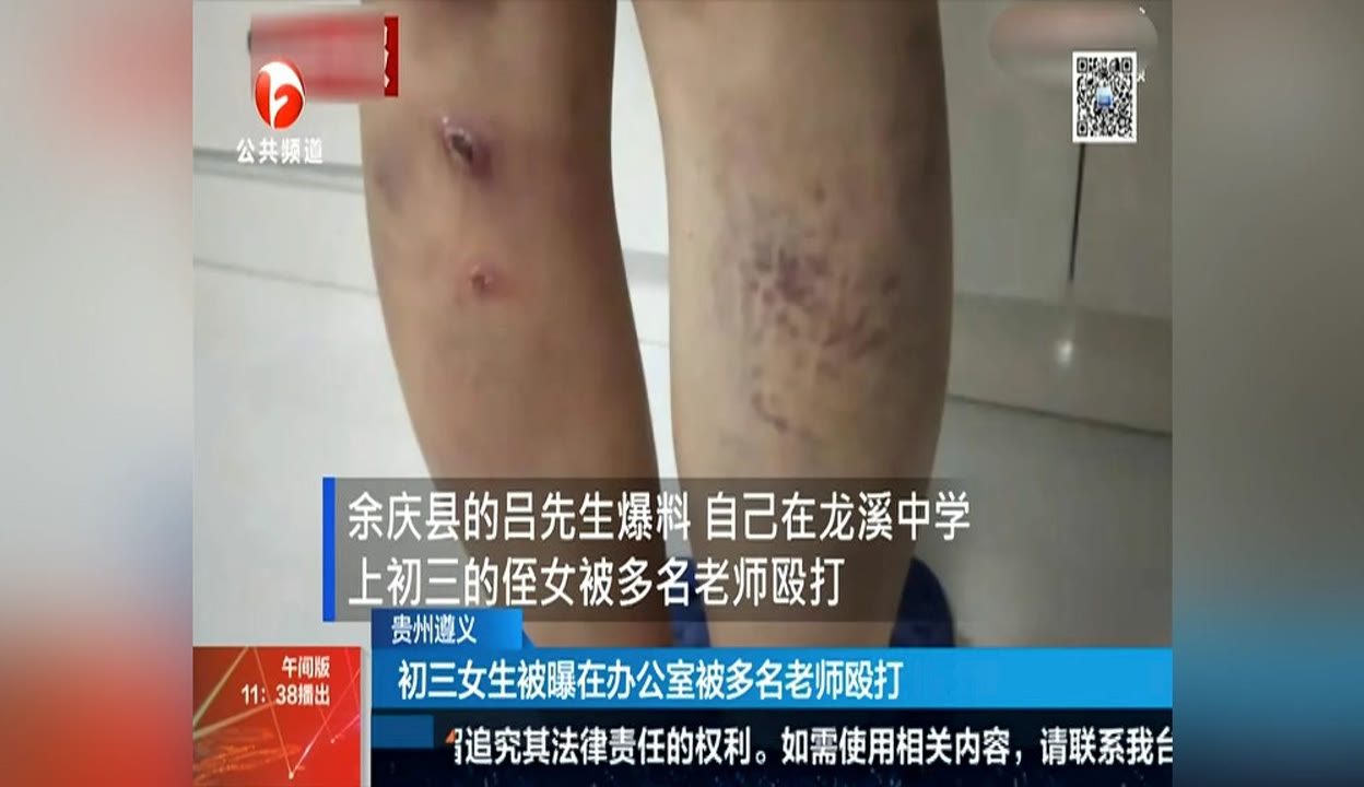 蓝色的思念流转】初三女生被曝在办公室被多名老师殴打-1万粉丝8千作品期待你的评论_资讯视频-免费在线观看-爱奇艺