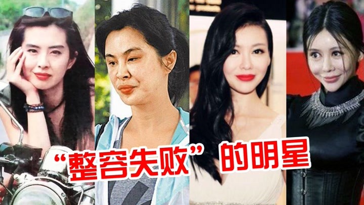 "整容失败"的明星,王祖贤女神变女鬼,张檬取出假体颜值回归
