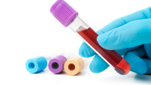 什么是血常规检查？检查项目有哪些？